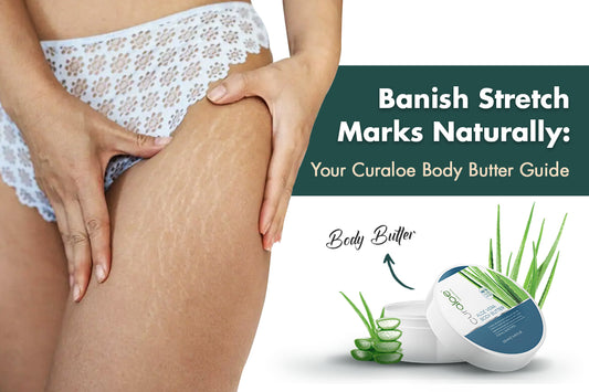 How to Keep Stretch Marks at Bay: Your Natural Curaloe Solution